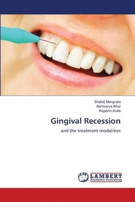 bokomslag Gingival Recession