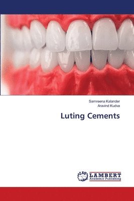 Luting Cements 1