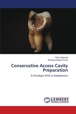 Rahul Agarwal, Sandhya Kapoor Punia - Conservative Access Cavity Preparation, Häftad