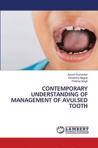 bokomslag Contemporary Understanding of Management of Avulsed Tooth