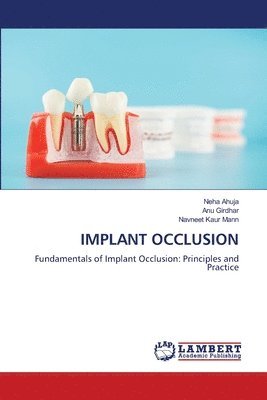 Neha Ahuja, Anu Girdhar, Navneet Kaur Mann - Implant Occlusion, Häftad