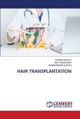 bokomslag Hair Transplantation