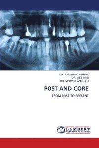 bokomslag Post and Core