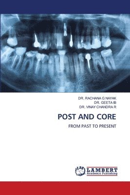 bokomslag Post and Core