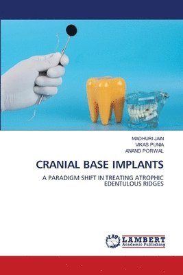 bokomslag Cranial Base Implants