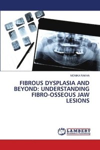 bokomslag Fibrous Dysplasia and Beyond: Understanding Fibro-Osseous Jaw Lesions