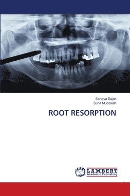 bokomslag Root Resorption
