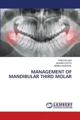 bokomslag MANAGEMENT OF MANDIBULAR THIRD MOLAR