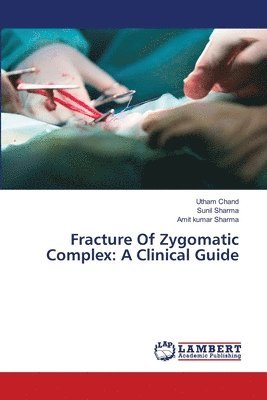 Utham Chand, Sunil Sharma, Amit Kumar Sharma - Fracture Of Zygomatic Complex, Häftad