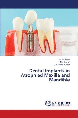 bokomslag Dental Implants in Atrophied Maxilla and Mandible