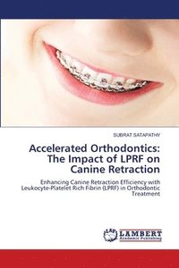 bokomslag Accelerated Orthodontics