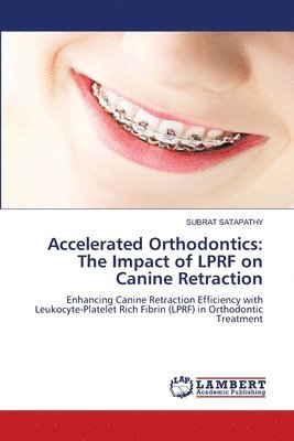 bokomslag Accelerated Orthodontics: The Impact of LPRF on Canine Retraction