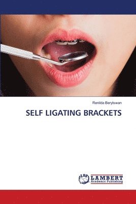 Self Ligating Brackets 1