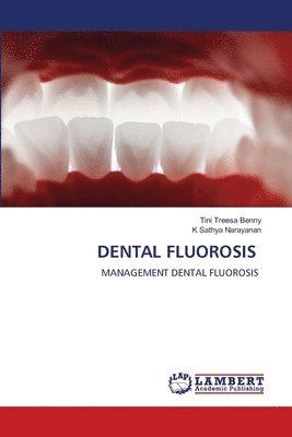 Tini Treesa Benny, K Sathya Narayanan, K. Sathya Narayanan - Dental Fluorosis, Häftad