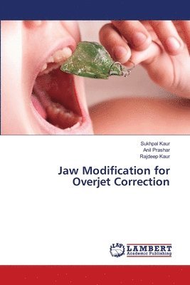 Sukhpal Kaur, Anil Prashar, Rajdeep Kaur - Jaw Modification for Overjet Correction, Häftad