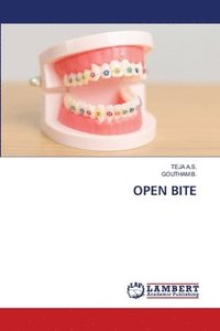 bokomslag Open Bite