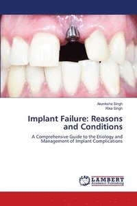bokomslag Implant Failure: Reasons and Conditions