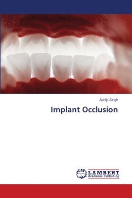 Abhijit Singh - Implant Occlusion, Häftad