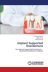 bokomslag Implant Supported Overdenture