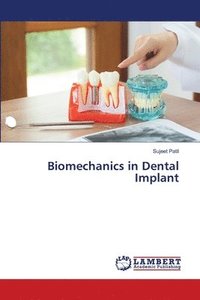 bokomslag Biomechanics in Dental Implant