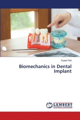 bokomslag Biomechanics in Dental Implant