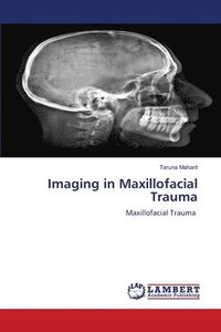 bokomslag Imaging in Maxillofacial Trauma