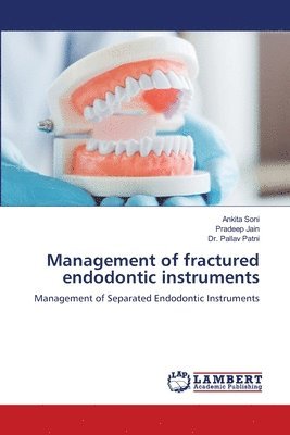 Ankita Soni, Pradeep Jain, Pallav Patni - Management of fractured endodontic instruments, Häftad