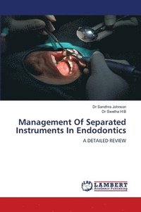 bokomslag Management Of Separated Instruments In Endodontics
