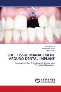 bokomslag Soft Tissue Management Around Dental Implant