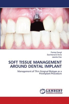 bokomslag Soft Tissue Management Around Dental Implant