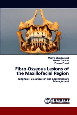 Fibro-Osseous Lesions of the Maxillofacial Region