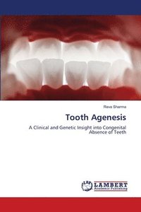 bokomslag Tooth Agenesis