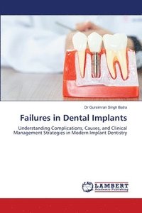 bokomslag Failures in Dental Implants
