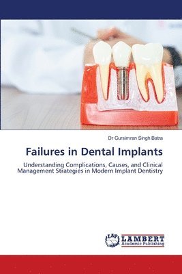 bokomslag Failures in Dental Implants
