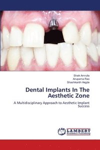 bokomslag Dental Implants In The Aesthetic Zone