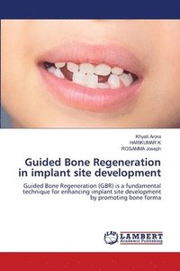 bokomslag Guided Bone Regeneration in implant site development