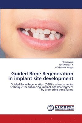 bokomslag Guided Bone Regeneration in implant site development