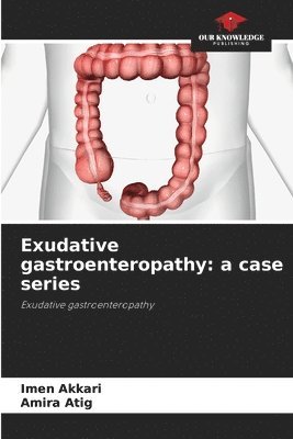 bokomslag Exudative gastroenteropathy: a case series