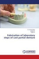 Fabrication of laboratory steps of cast partial denture
