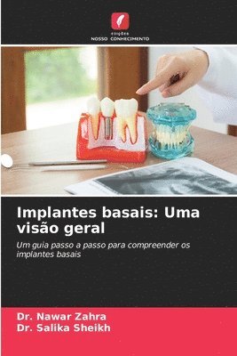 bokomslag Implantes basais