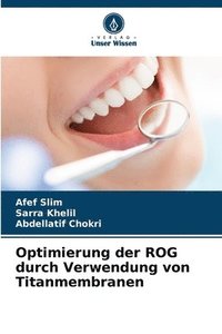 bokomslag Optimierung der ROG durch Verwendung von Titanmembranen