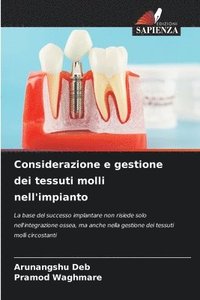 bokomslag Considerazione e gestione dei tessuti molli nell'impianto