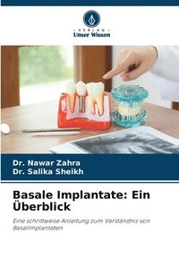 bokomslag Basale Implantate