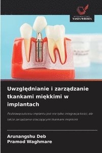 bokomslag Uwzgl?dnianie i zarz?dzanie tkankami mi?kkimi w implantach