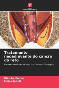 bokomslag Tratamento neoadjuvante do cancro do reto