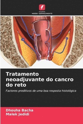 bokomslag Tratamento neoadjuvante do cancro do reto