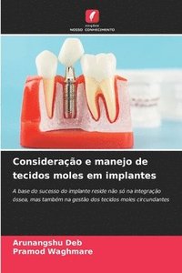 bokomslag Consideração e manejo de tecidos moles em implantes