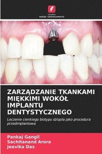 bokomslag Zarz?dzanie Tkankami Mi?kkimi Wokól Implantu Dentystycznego
