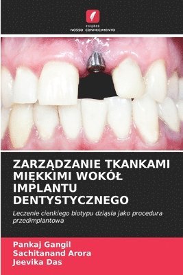 bokomslag Zarz?dzanie Tkankami Mi?kkimi Wokól Implantu Dentystycznego