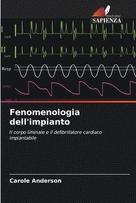 bokomslag Fenomenologia dell'impianto